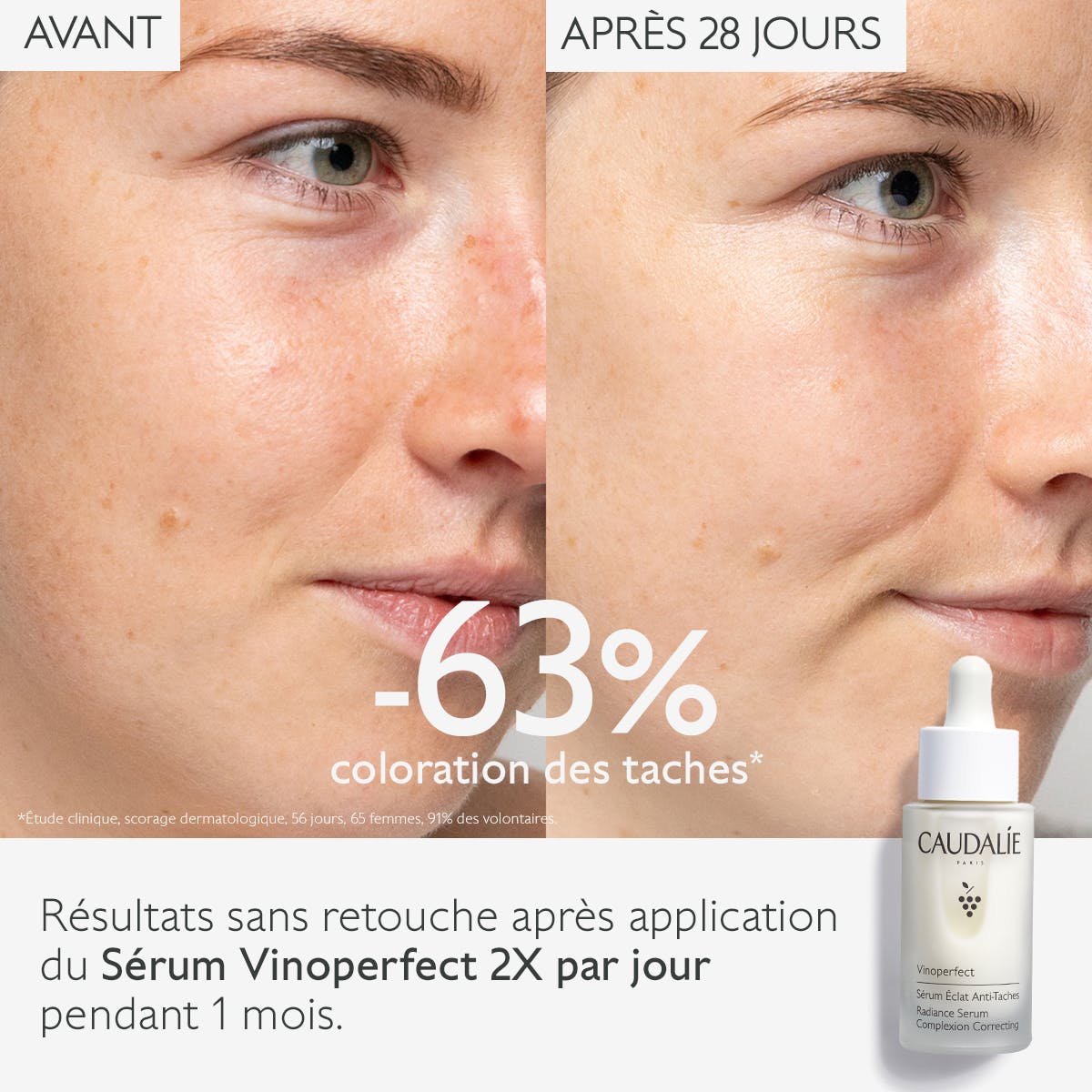 caudalie anti-taches serum vinoperfect avant apres